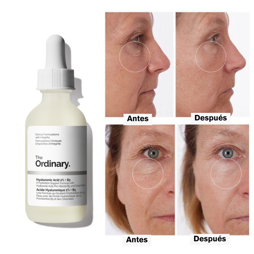 The Ordinary Ácido Hialurónico 2% + B5 (con ceramidas)