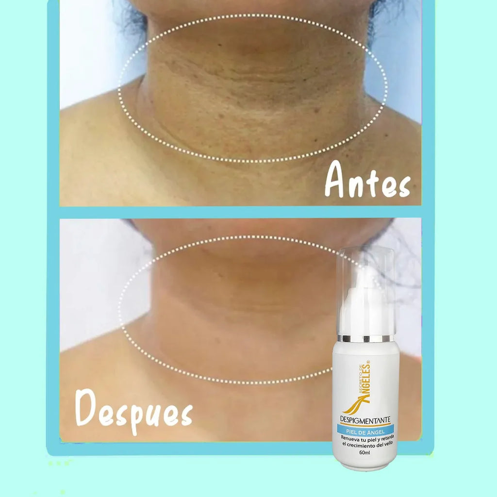 DESPIGMETANTE PIEL DE ANGEL X 2 SECRETO