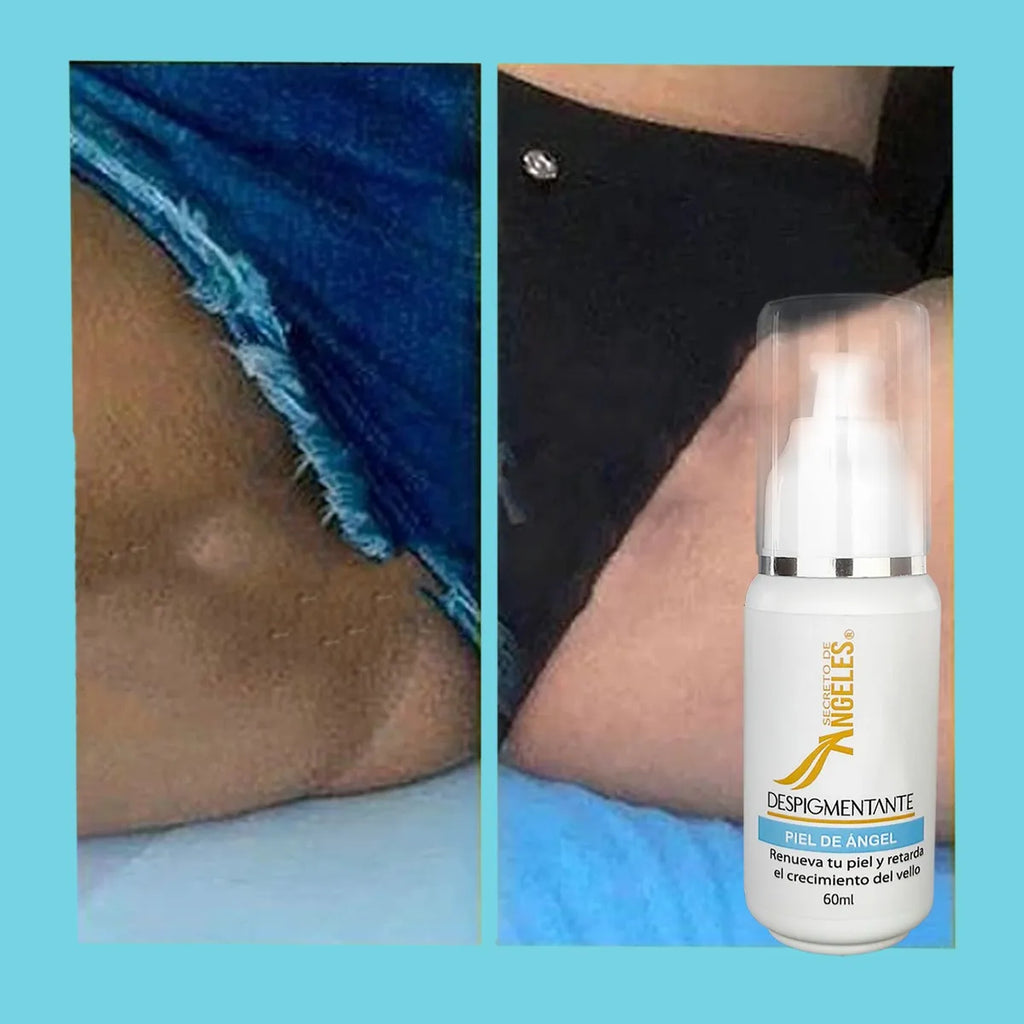 DESPIGMETANTE PIEL DE ANGEL X 2 SECRETO
